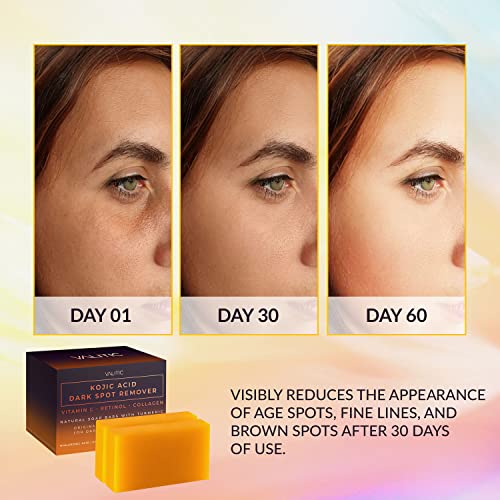 Kojic Dark Spot Soap
