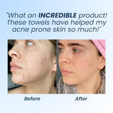Disposable Face Wipes
