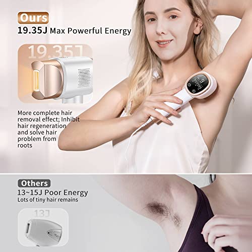 Unisex Laser Hair Removal